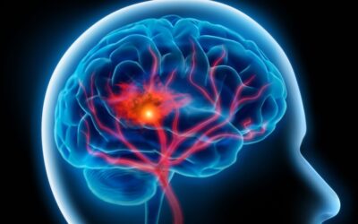 Stroke Recovery and the Role of Oxygen: A Supportive Approach to Healing